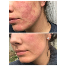 Load image into Gallery viewer, Unwind